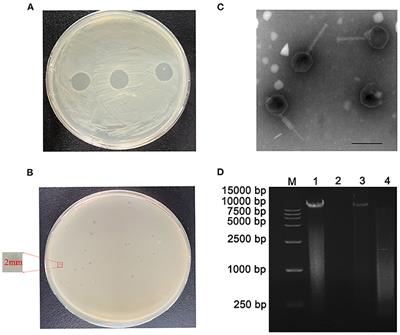 The Bacteriophage vB_CbrM_HP1 Protects Crucian Carp Against Citrobacter braakii Infection